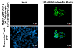 Anti-Myosin Light Chain 2 (MLC-2v) (phospho Ser15) antibody [HL2891] used in Immunocytochemistry/ Immunofluorescence (ICC/IF). GTX640170